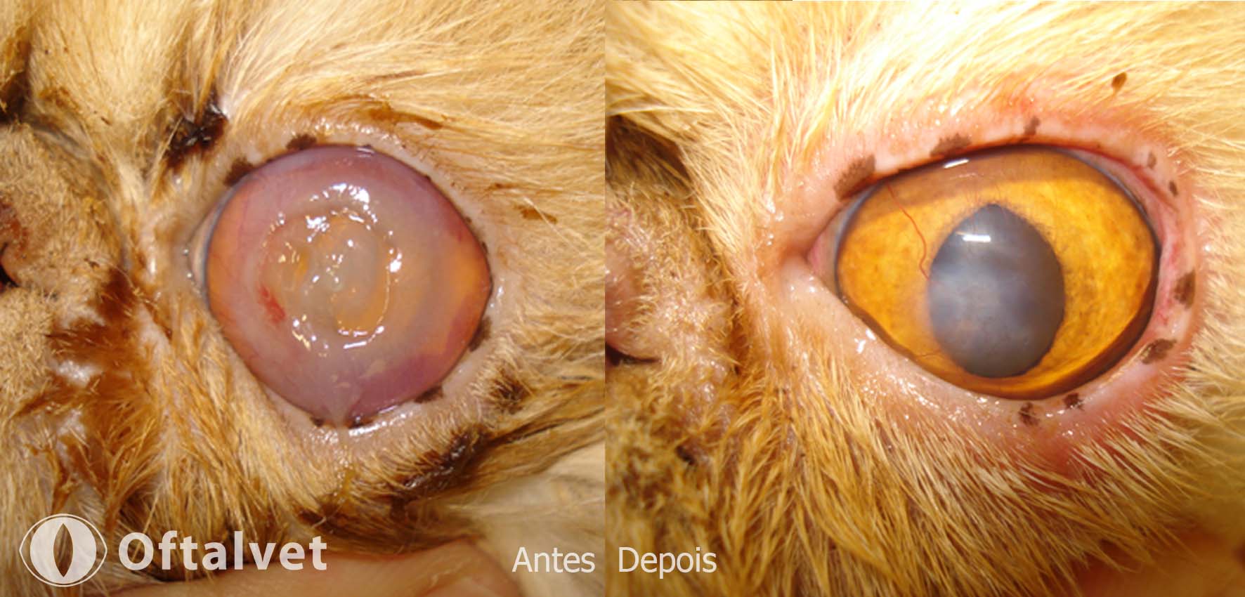 sequestros cornea